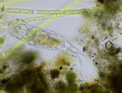 Cephalodella forficula thumbnail 2