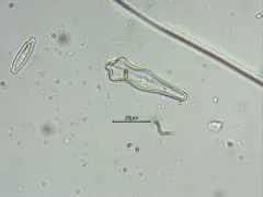 Gomphonema acuminatum thumbnail 4