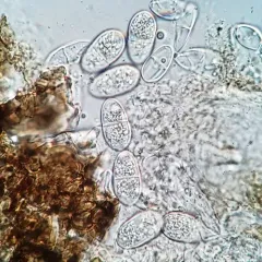 Arthonia granosa thumbnail 4