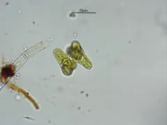 Staurastrum alternans thumbnail 3