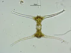 Staurastrum leptocladum thumbnail 2