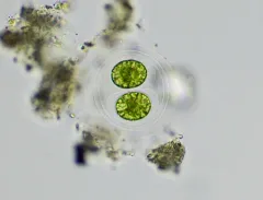 Asterococcus superbus thumbnail 3