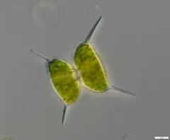 Staurodesmus validus thumbnail 2
