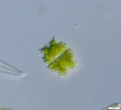 Euastrum denticulatum thumbnail 2
