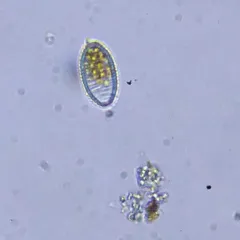 Diatoma vulgaris thumbnail 3
