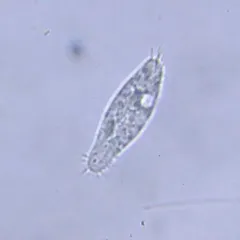 Holosticha pullaster thumbnail 3
