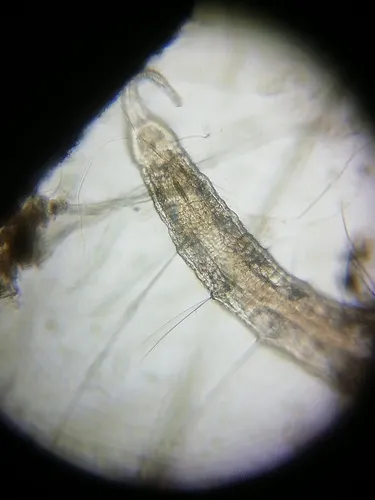 Stylaria fossularis