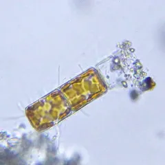 Melosira varians thumbnail 2