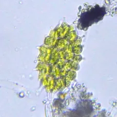 Pseudopediastrum boryanum thumbnail 4