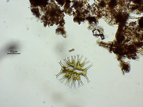 Micrasterias furcata