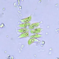 Tetradesmus dimorphus thumbnail 3