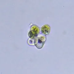 Coelastrum pseudomicroporum thumbnail 1