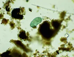 Stentor multiformis thumbnail 3