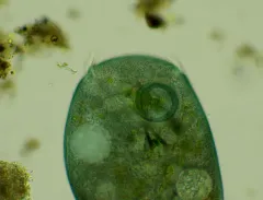 Stentor coeruleus thumbnail 3