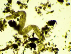 Spirostomum ambiguum thumbnail 2