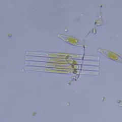 Fragilaria crotonensis thumbnail 4