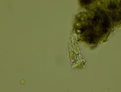 Cephalodella auriculata thumbnail 2