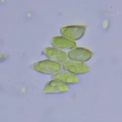 Tetradesmus obliquus thumbnail 4