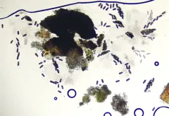 Splanchnonema ampullaceum thumbnail 1