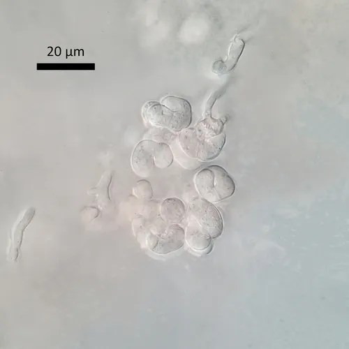 Illosporiopsis christiansenii