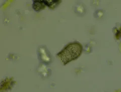 Codonella cratera thumbnail 1