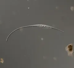 Amphileptus procerus thumbnail 2
