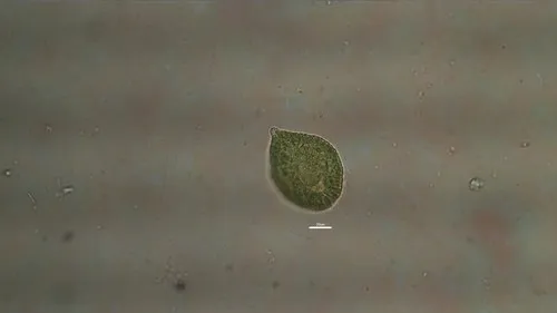 Gonyostomum semen