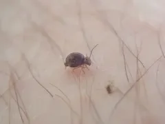 Pseudobourletiella spinata thumbnail 2