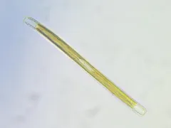 Nitzschia sigmoidea thumbnail 4