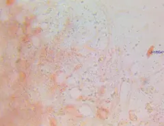 Ditangium cerasi thumbnail 2