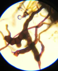 slender-toothed earth moss thumbnail 4