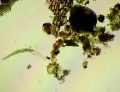 Spirostomum teres thumbnail 3
