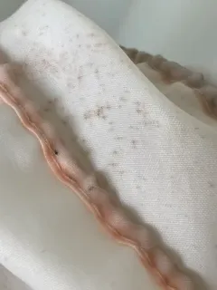 Serratia marcescens thumbnail 4