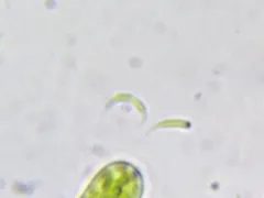 Monoraphidium contortum thumbnail 3