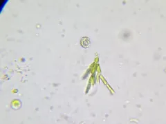 Microthamnion kuetzingianum thumbnail 3