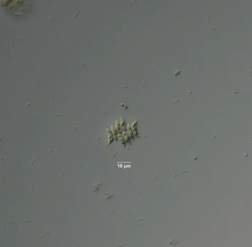 Tetradesmus obliquus