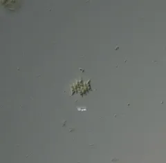 Tetradesmus obliquus thumbnail 1