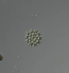 Pediastrum duplex thumbnail 1