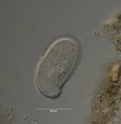 Colpidium colpoda thumbnail 1