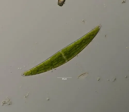 Closterium moniliferum