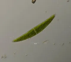 Closterium moniliferum thumbnail 1
