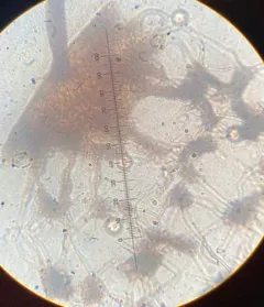 Cribraria microcarpa thumbnail 4