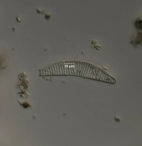 Epithemia turgida
