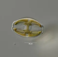 Amphora ovalis thumbnail 1