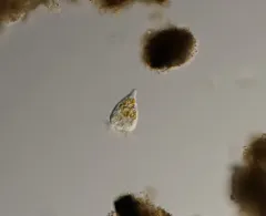 Strobilidium caudatum thumbnail 1