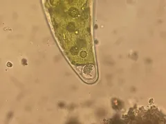 Closterium ehrenbergii thumbnail 3