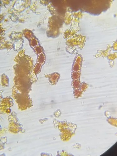 Trentepohlia umbrina
