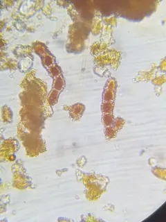 Trentepohlia umbrina thumbnail 1