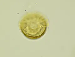 Arcella vulgaris thumbnail 2