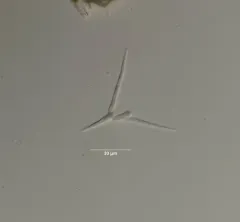 Tetracladium marchalianum thumbnail 1
